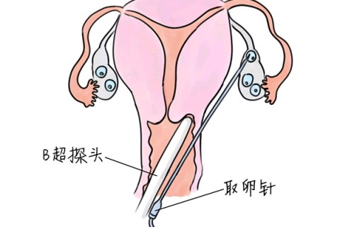 http://ningbo.vdtfzz.com/post/205.html|宁波供卵助孕